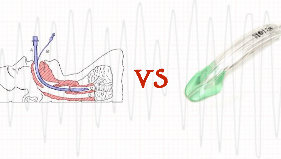Endotracheal Intubation vs. Supraglottic Airway Placement for Out-of-Hospital Cardiac Arrest