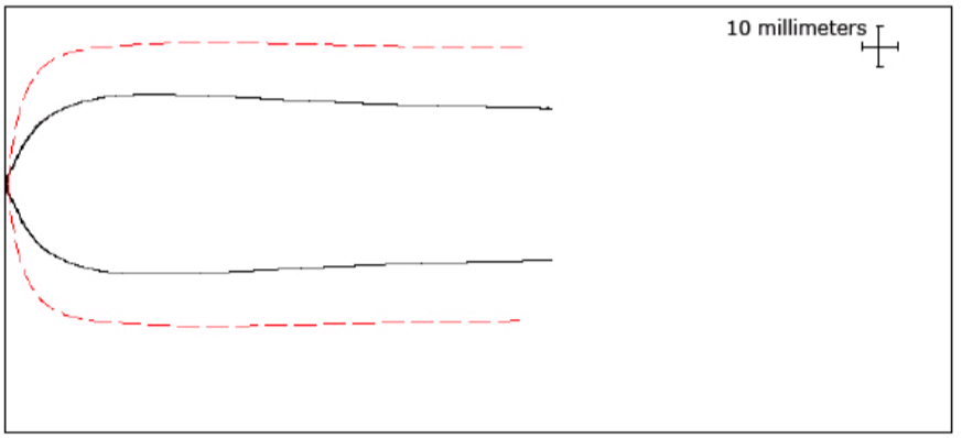 Thromboelastography aka The TEG