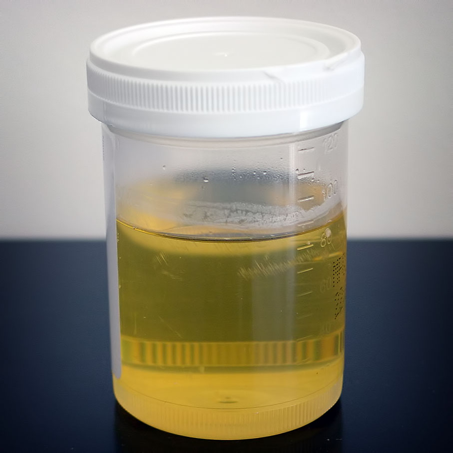 What Color Should Urine Be for a Drug Test?