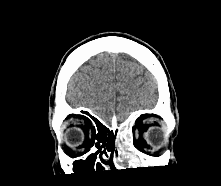 Annals of B-Pod: Quick Hit Case