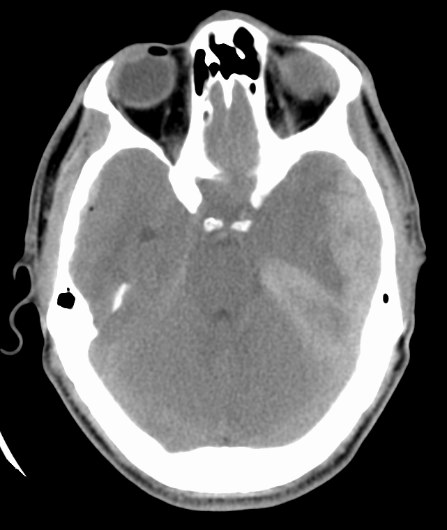 Annals of B-Pod: Beware of the "Drunk"