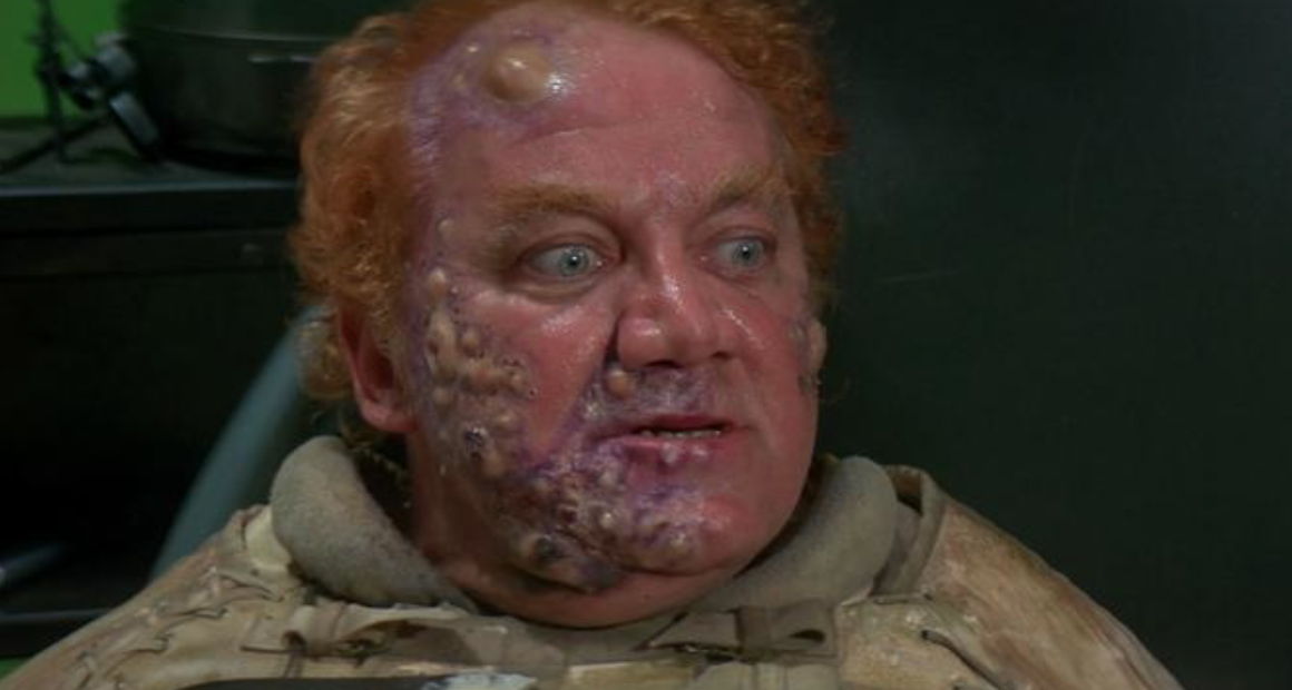 Crash and Burn Part 2 - Approach to the MVC Patient