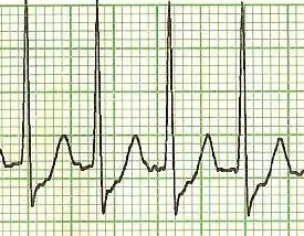 Grand Rounds Recap 11.9.16