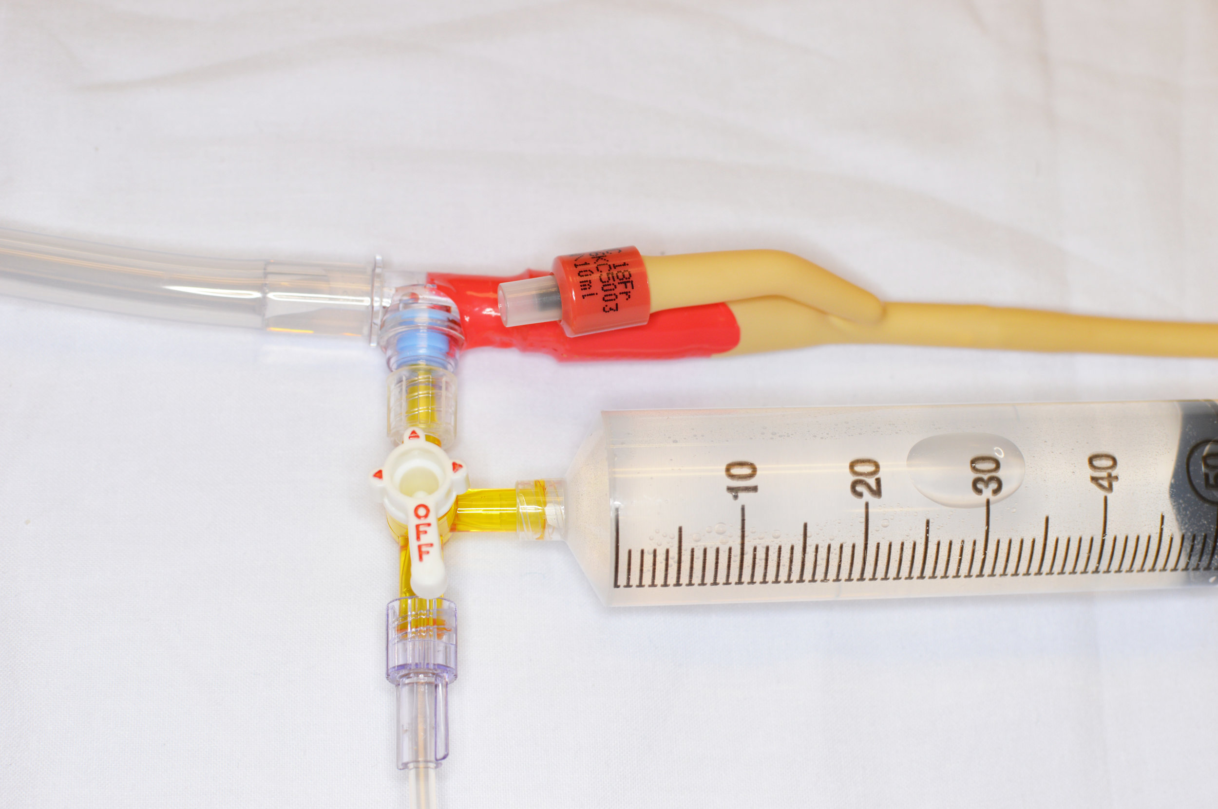 Annals of BPod Abdominal Compartment Syndrome — Taming the SRU