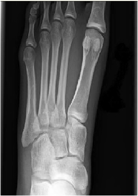 Annals of B-Pod: Quick Hit Case