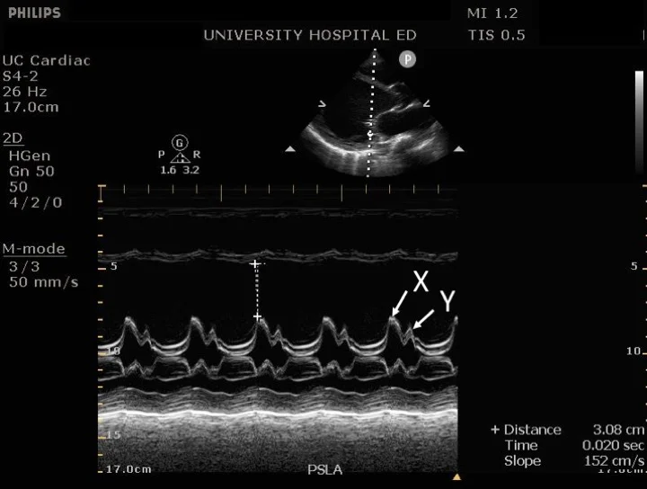 Cardiac Ultrasound Q&A