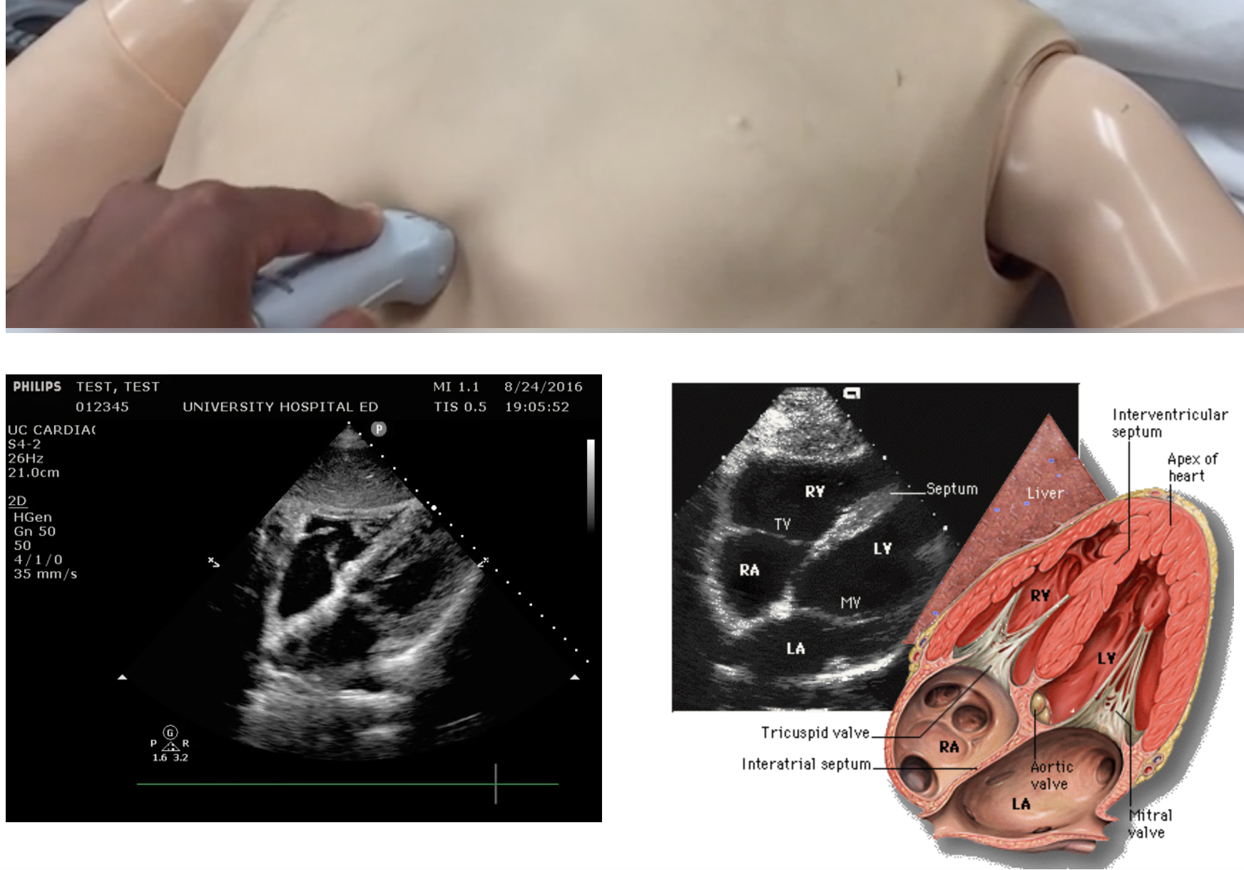 cardiac ultrasound.png