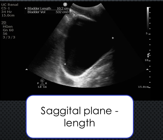 bladder saggital.png