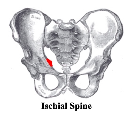 XR ischial spine.jpg