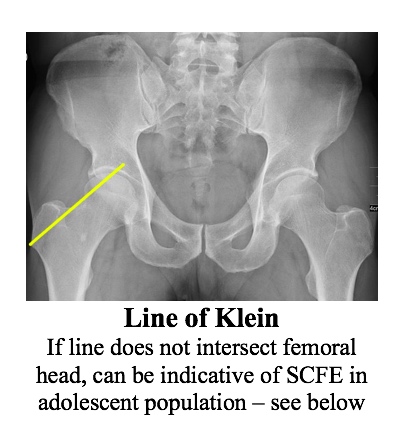 XR line of klein.jpg