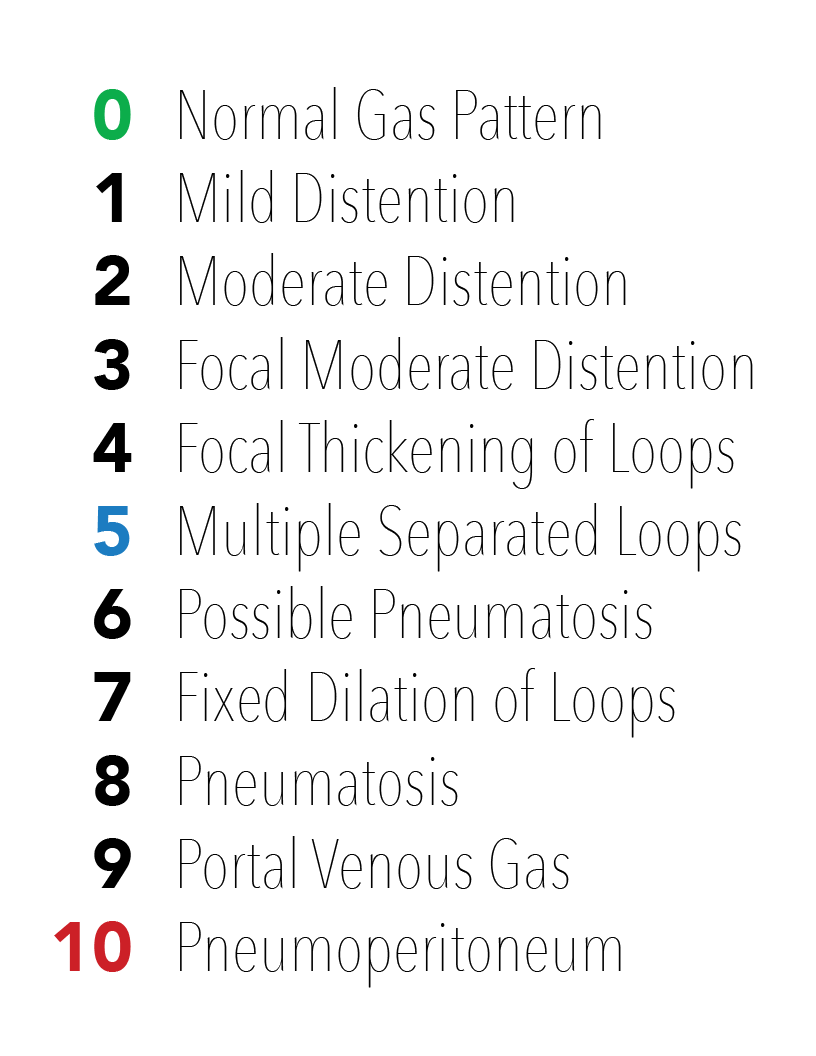 The Abdominal XRay: A relic or a reliable tool? — Taming the SRU