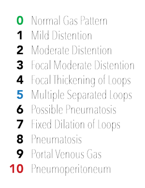 The Abdominal XRay: A relic or a reliable tool? — Taming the SRU