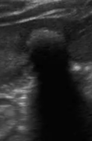 Still image of wall-echo-shadow complex