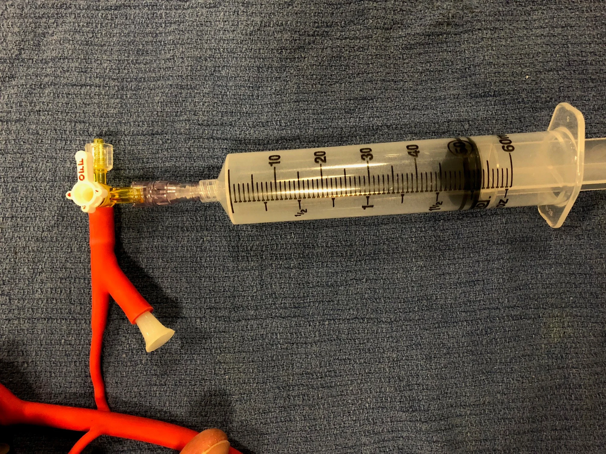 Picture 4: Inflate 50 mL of air into gastric balloon