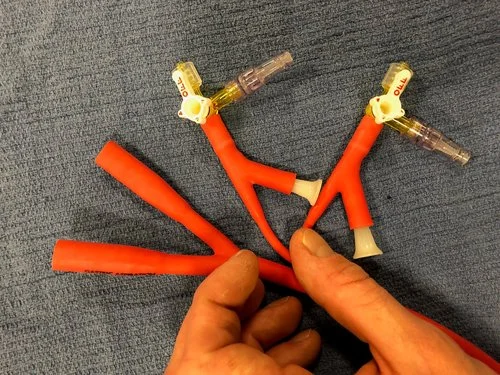 Picture 3: IV caps on three way stop cocks in minnesota tube balloon inflation ports