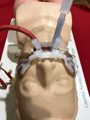 Picture 9: One Hollister is used for both ETT and Minnesota tube; an additional tube clamp is placed in series next to the ETT clamp.