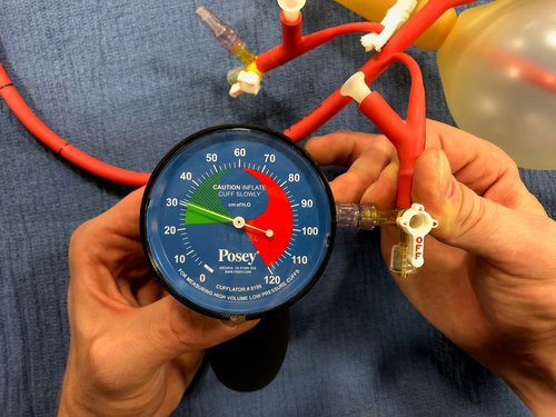Picture 7: Using Cufflator inflate the esophageal balloon to 30 mmHg