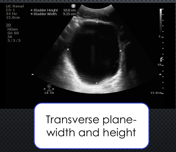 bladder+transverse.png