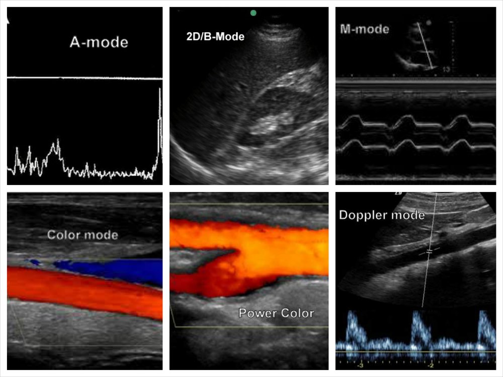 Ultrasound Machines - Knobology — Taming the SRU