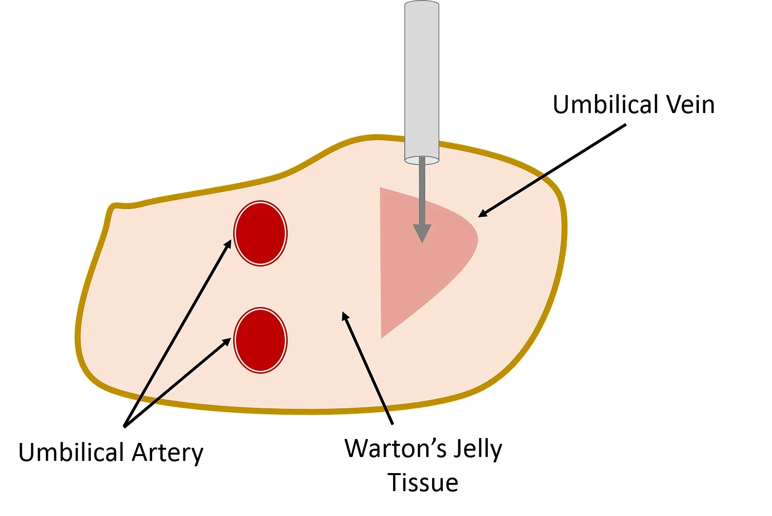 Figure 1: Cross-sectional representation of the umbilical cord in the context of umbilical vein catheter insertion