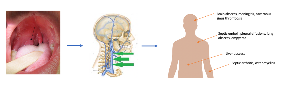 Basic acidic has uses fork polarity modification