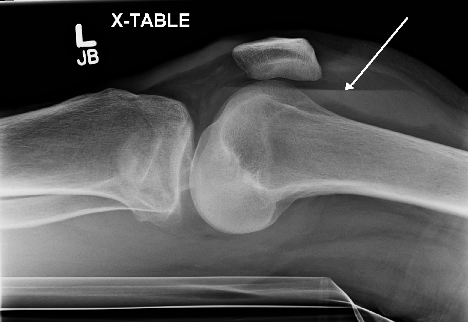 Diagnostics Knee And Ankle X rays Taming The SRU