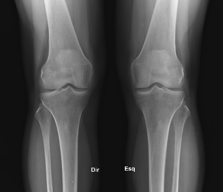 Diagnostics: Knee and Ankle X-rays — Taming the SRU