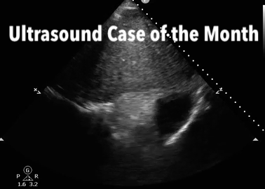 Ultrasound case of the month - Placement comes first