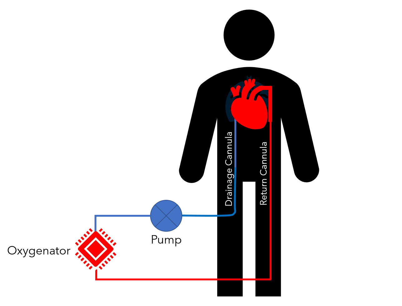 Air Care Series: No Heart, No Problem — Taming the SRU