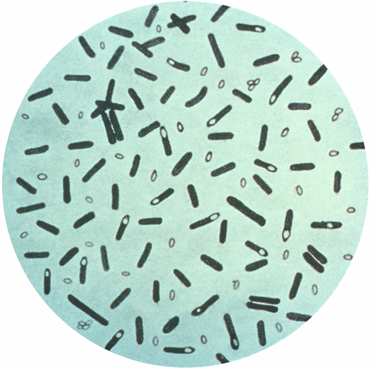 Annals of B Pod - Infantile Botulism