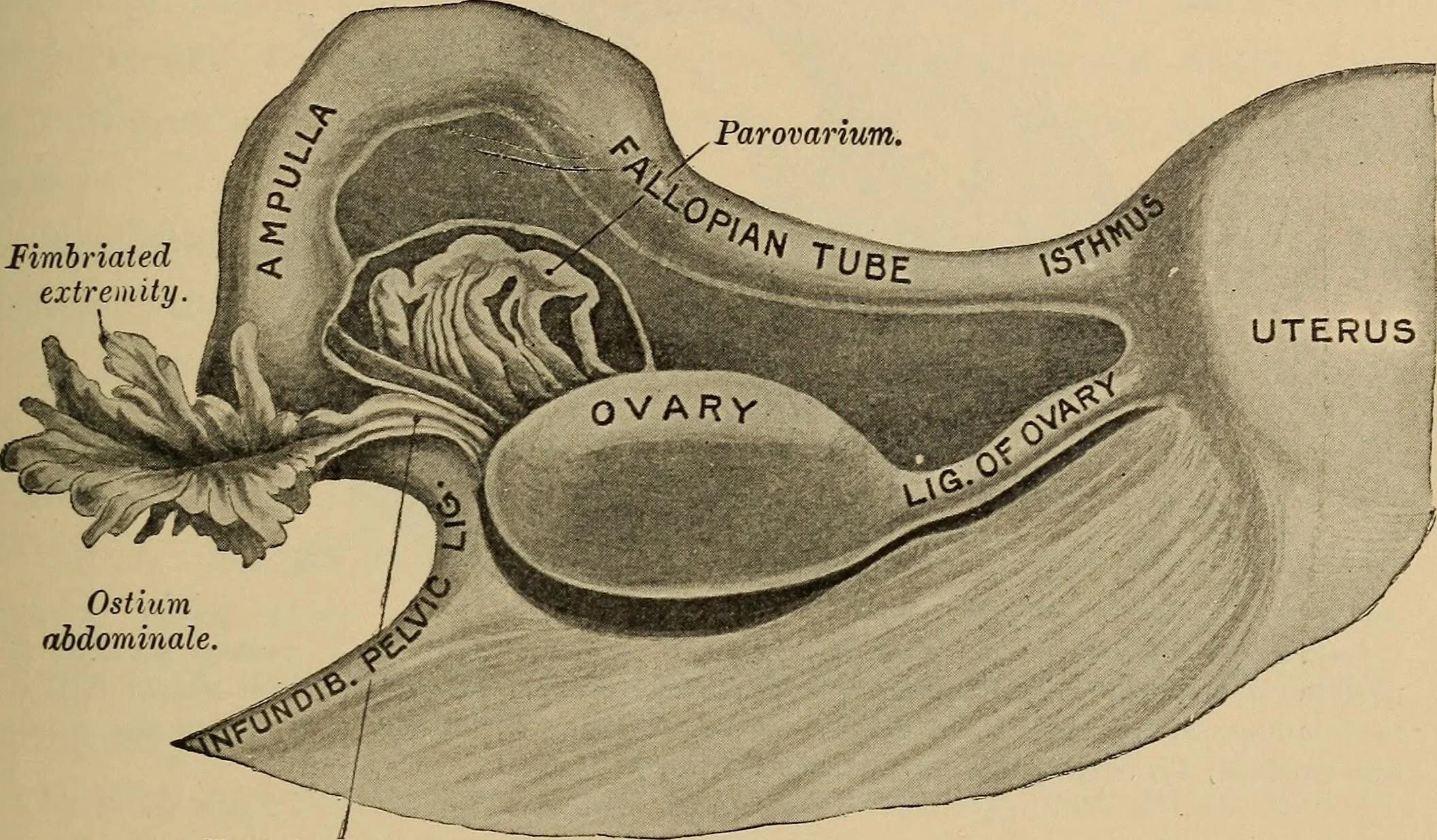 Annals of B Pod - Ovarian Torsion