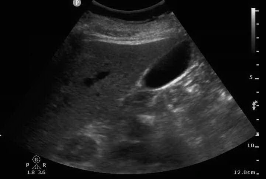 ultrasound-tips-always-always-always-taming-the-sru