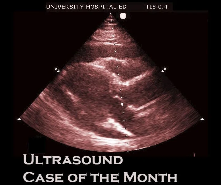 Ultrasound Tips: Always, Always, Always ...