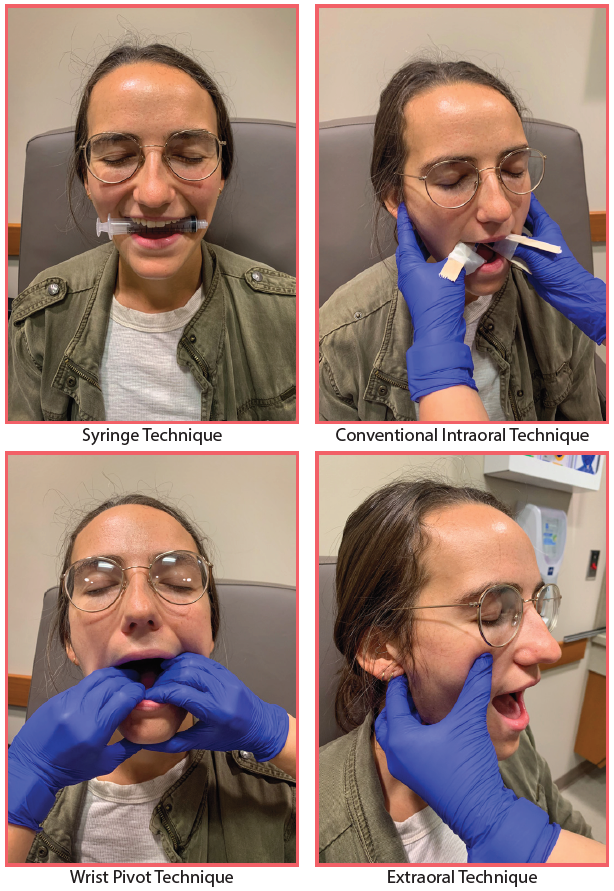 Annals of B Pod Jaw Dislocation — Taming the SRU