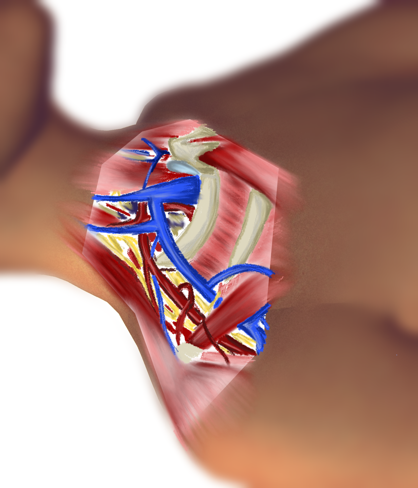 Anatomy of a Procedure - Subclavian Cannulation