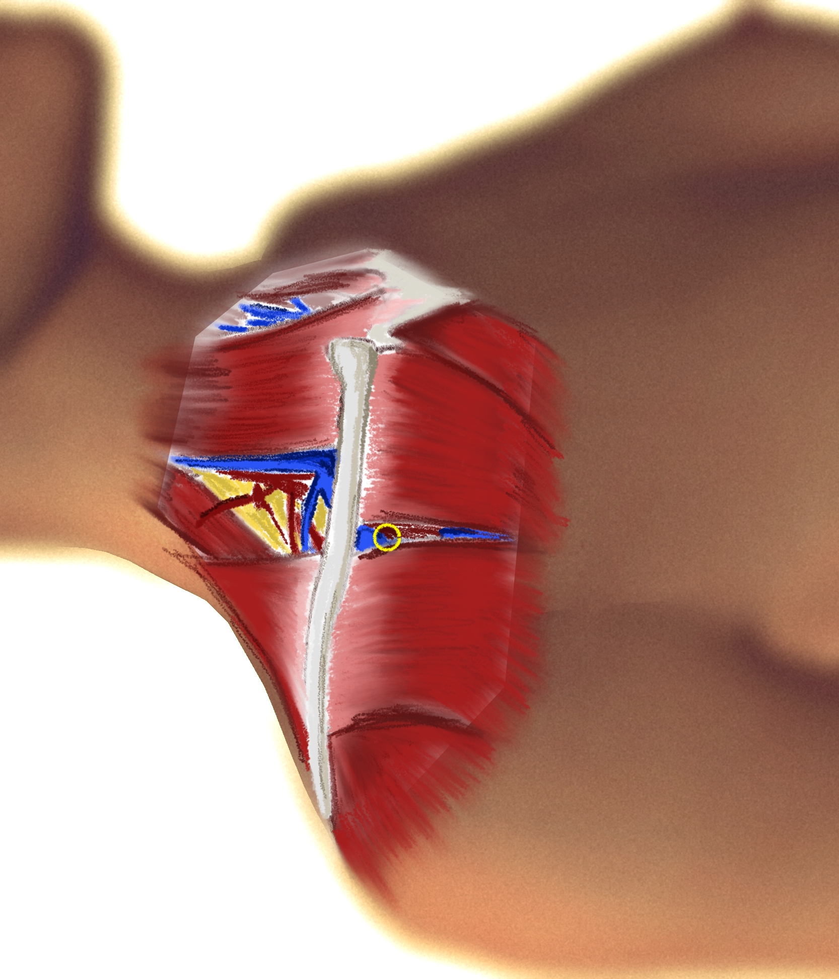 Subclavian First Layer INFRACLAVICULAR.png