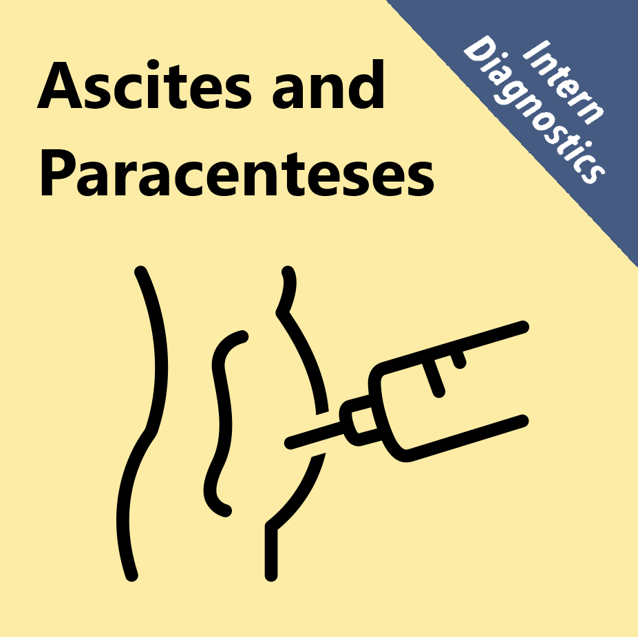 Diagnostics and Therapeutics: Paracentesis in the Emergency Department