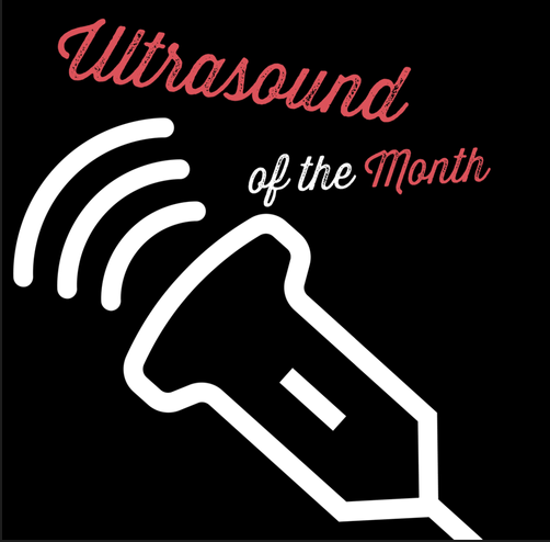 Ultrasound of the Month: Ocular Abscess