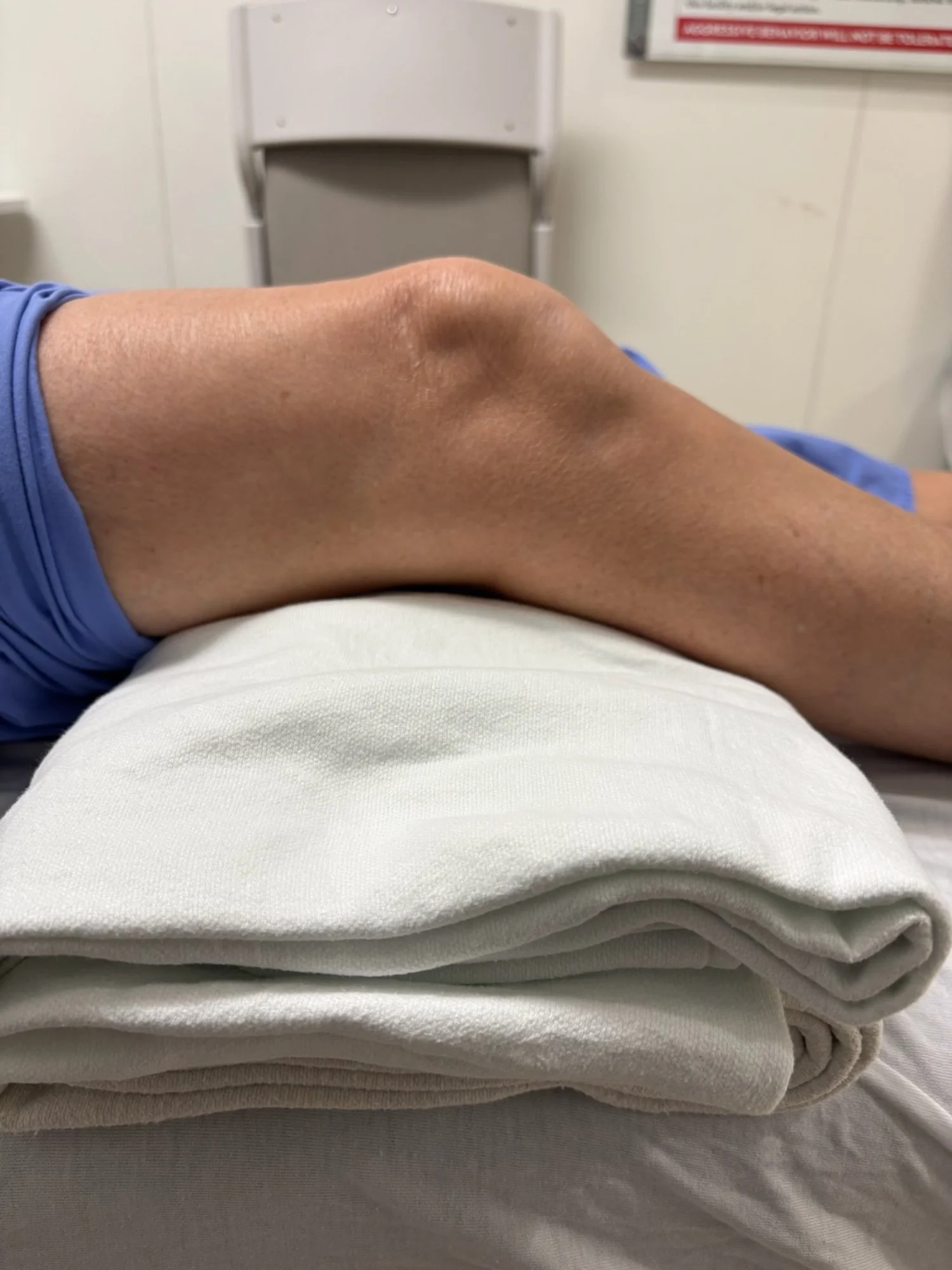 Image 4: Correct positioning of the knee for ultrasound evaluation