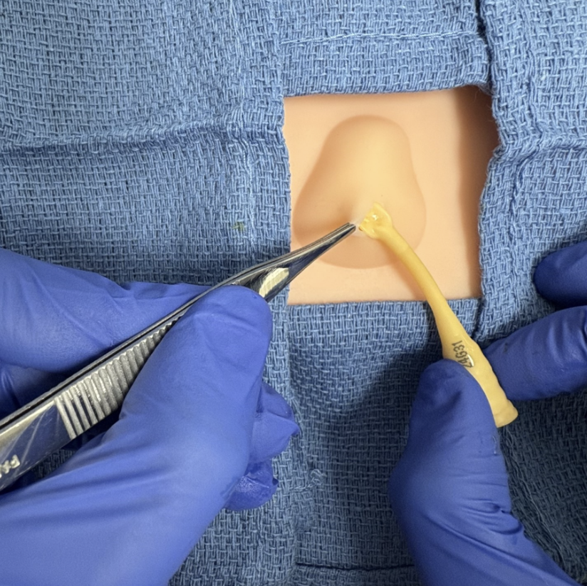 Mastering Minor Care Bartholin Gland Abscess Taming The SRU mastering-minor-care-bartholin-gland-abscess-taming-the-sru