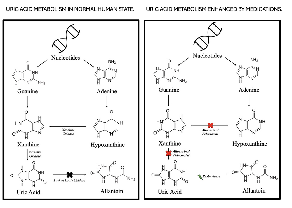 Diagnostics and Therapeutics: Tumor Lysis Syndrome — Taming the SRU