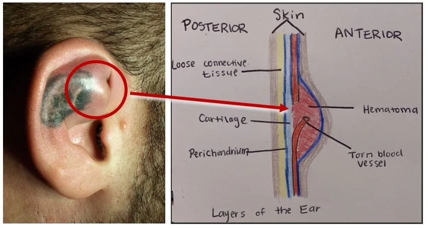 Diagnostics and Therapeutics: Ear Emergencies in the Department ...