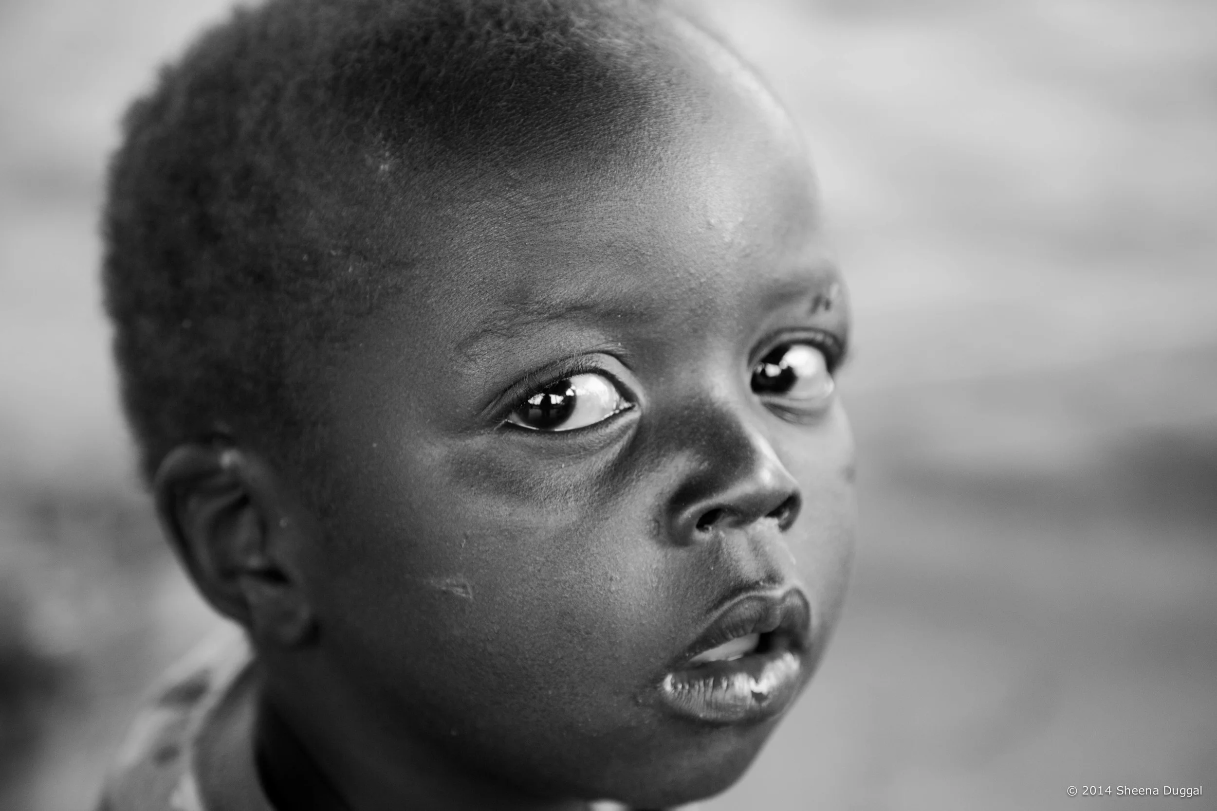 Scarlet fever, Zimbabwe