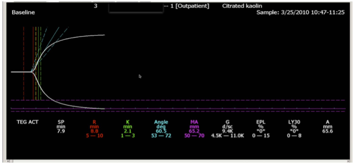 Fig. 1. BasicTEG. All parameters are within the normal ranges. There is no significant risk of hemorrhage or thrombosis.