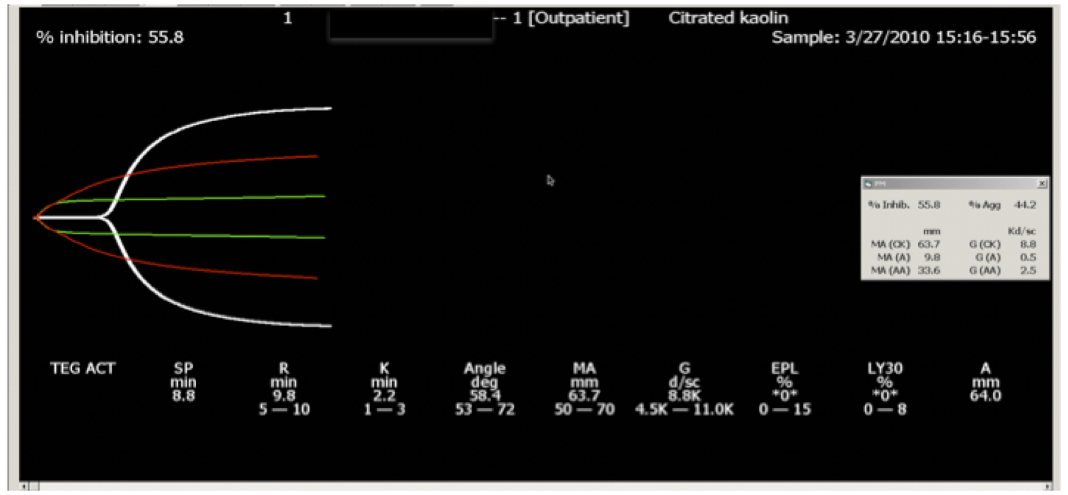 Fig. 3: The AA inhibition is approximately 57%, a therapeutic level of inhibition.