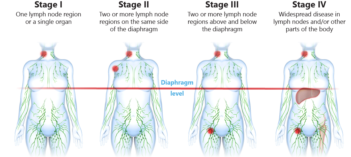 Staging MCL-01.png