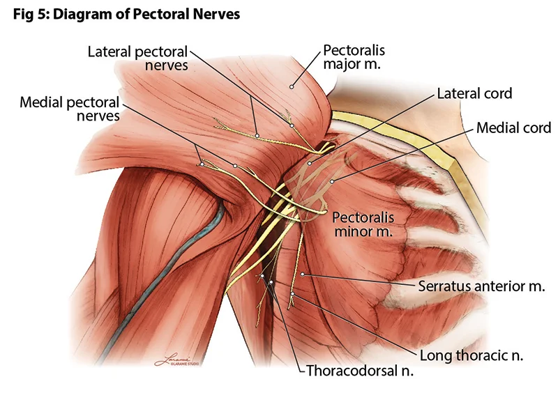 Pectoral Nerves