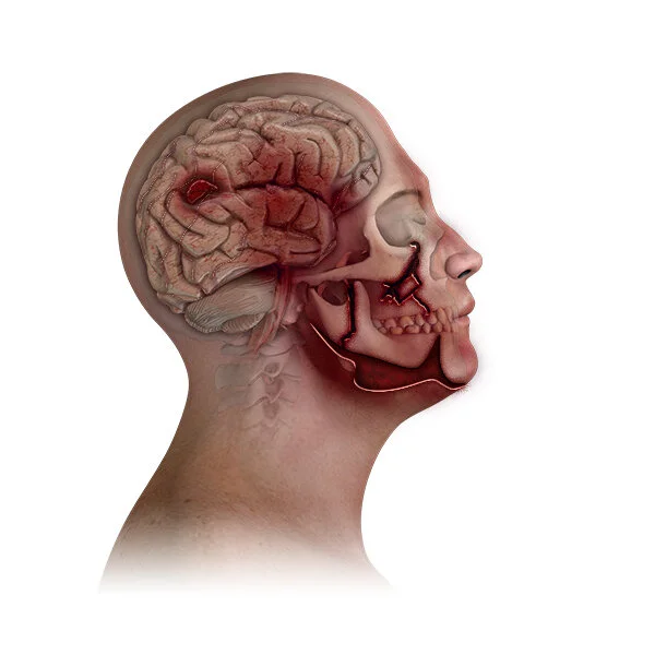 Skull&Brain_R.jpg