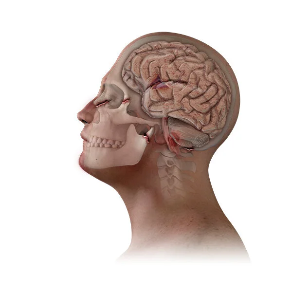 Skull&Brain_L.jpg