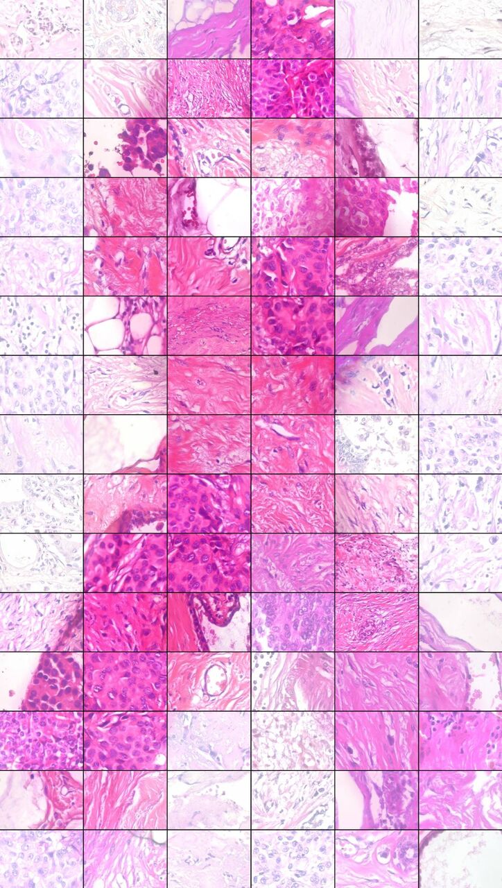 breast cancer ribbon_histology.jpg